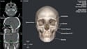 do medical imaging, 3d visualization, dicom, image analysis, python