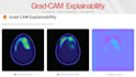 add gradcam explainability and visualization to your pytorch model
