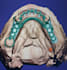 create high quality dental cad desings using exocad