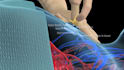 create 3d medical surgery animation and surgical procedure