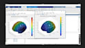 mechanical engineering design cfd and fea simulation