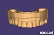 do professional dental cad design using exocad