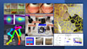 computer vision and deep learning models for medical image analysis