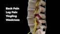 create 3d orthopedic spine and musculoskeletal animation anatomy video