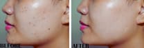 edit bulk photos retouching fast