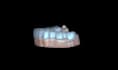 design occlusal splints, night guards and retainers