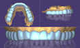 design occlusal splints, night guards and retainers