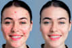 do professional skin retouching and remove acne blemishes
