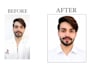 edit and retouch your photos professionally