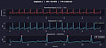 ecg signal processing, arrhythmia detection, and biomedical data analysis