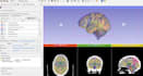create research grade brain ct mri dicom 3d segmentation and models