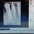 give dental second opinion