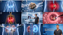 create 3d medical animation and surgical videos