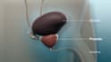 create 3d robotic surgery animation robot assisted prostatectomy viodeo