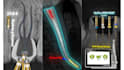 create engaging endodontic dental motion graphics videos
