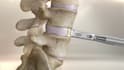 create 3d surgical animation, medical visualization and anatomy videos