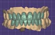 dental cad design service