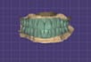 professional exocad dental cad design