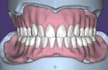 design precise full dentures using exocad