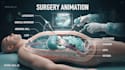 create scientific 3d medical animation videos