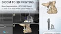 develop medical imaging cad software for dicom bone segmentation and 3d printing