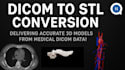 convert dicom to stl for medical 3d printing