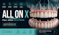 do professional all on x and full arch dental cases on exocad