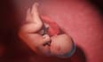 create best 3d medical explainer animation video for 3d sepsis retained placenta