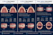 do orthodontic treatment planning and clear aligner setups