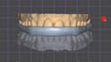 design custom cad night guards and occlusal splints