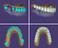 design precise exocad dental crowns, bridges and veneers