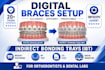 design digital braces setup and indirect bonding trays