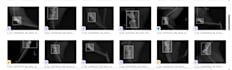 annotate medical images with precise masks, polygons and bounding boxes