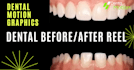 create professional dental before after reel with motion graphics
