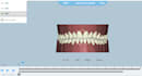 do clear aligner treatment planning setup and stepping