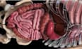 create 3d medical animation surgery anatomical 3d medical device explainer video