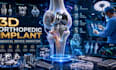 create 3d orthopedic implant medical device animation