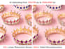 upscale image resolution and sharpen fine details using ai