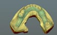do exocad dental cad design