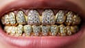 design really good grillz