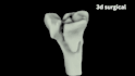create 3d medical animation, surgical animation, surgery animation video