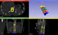 do 3d medical image segmentation and dicom conversion to stl
