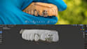 design 3d cad models for custom dental grillz stl