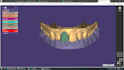 create professional dental cad designs using exocad
