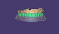 design custom crowns, bridges using exocad