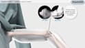 3d medical device animation and surgical product visualization