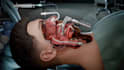 create 3d medical animation surgery medical device and anatomy device procedure