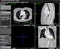 segment and analyze ct and mri medical images in imagej