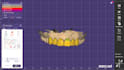 create functional and aesthetic digital dental designs