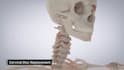 do 3d cervical disc replacement spine surgery animation and medical explainer